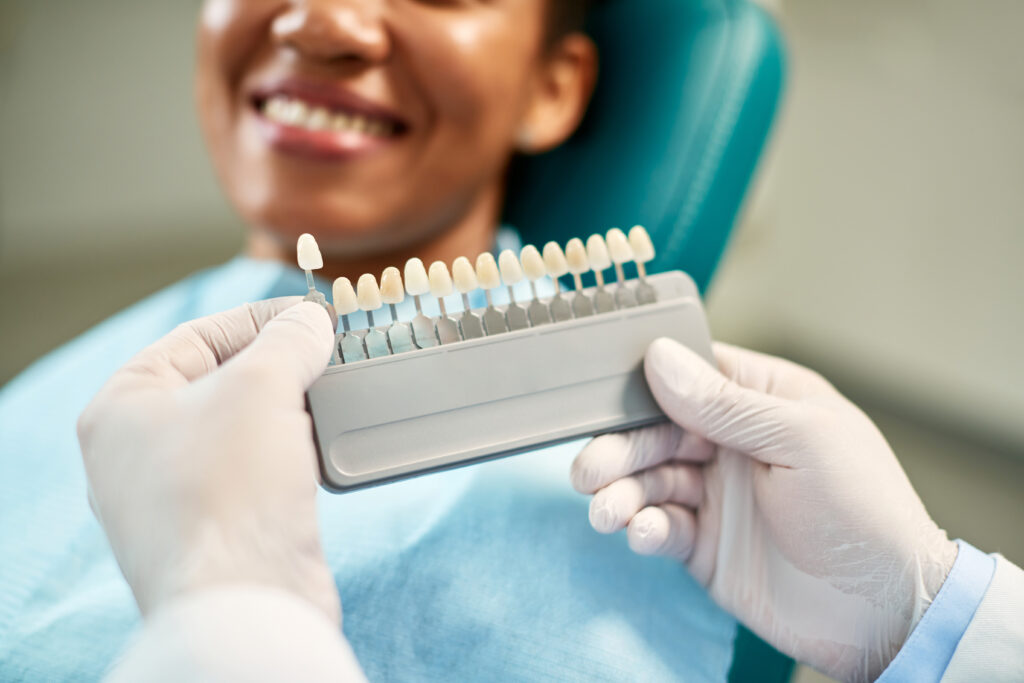 Close up of dentist chooses right shade of implants during dental appointment with female patient