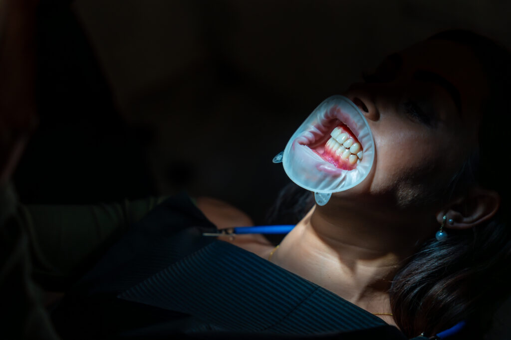 Patient undergoing teeth whitening procedure in dental clinic